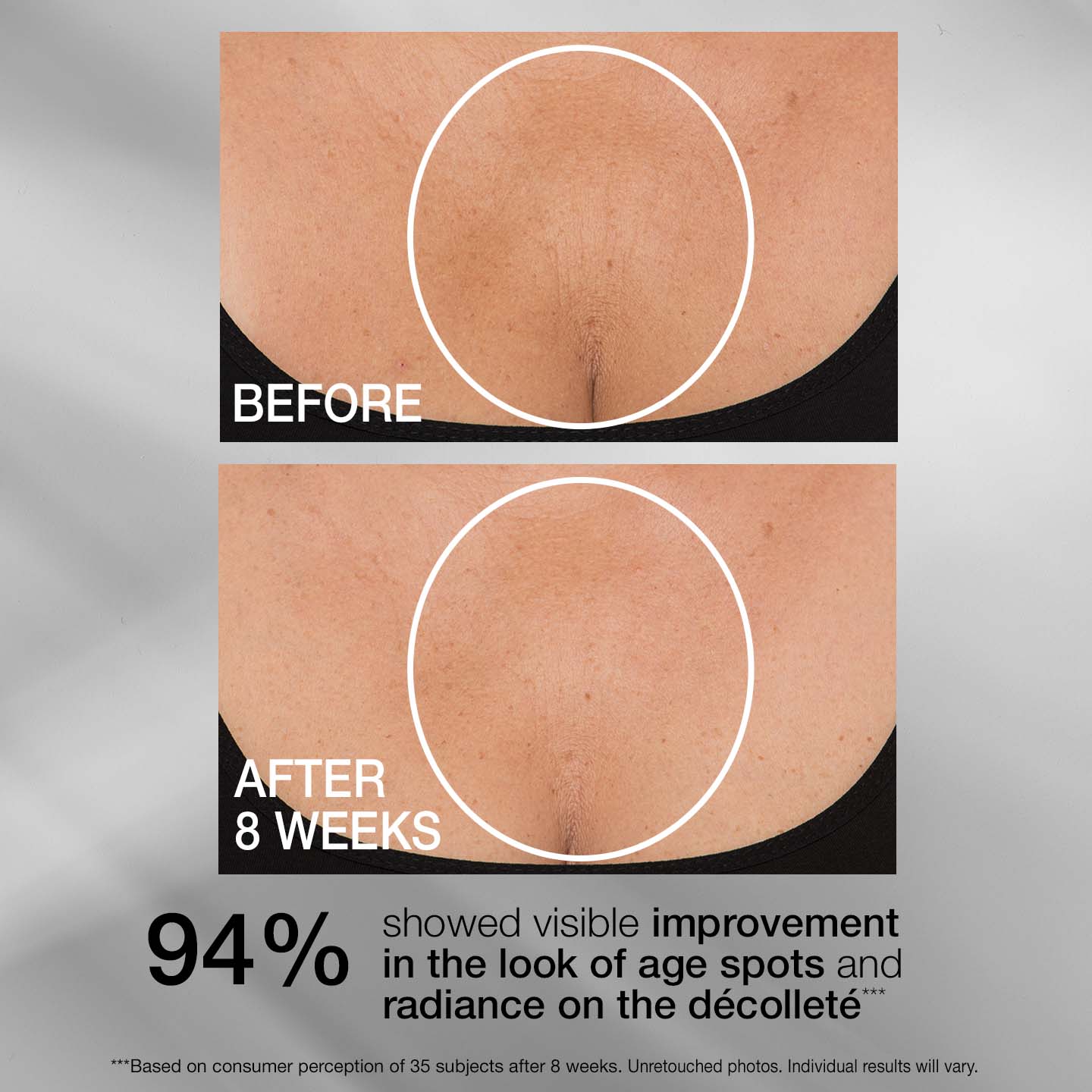 TL ADVANCED® TIGHTENING NECK CREAM PLUS